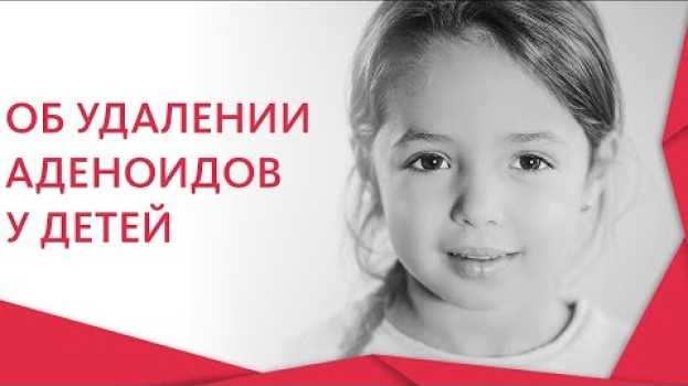 Video Удаление аденоидов у детей. 🚼 Нужно ли удалять аденоиды у детей? Альфа — Центр Здоровья.  12+   türkçe