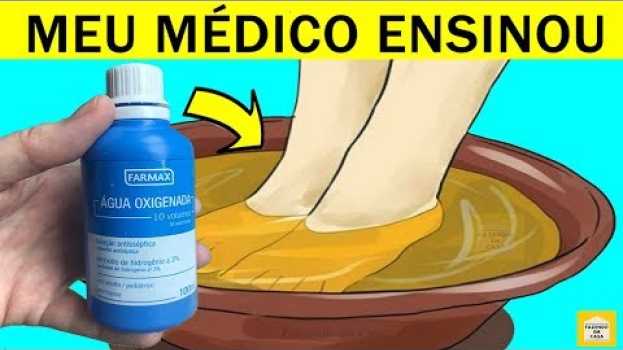 Video O Que Quase Ninguém Sabe Sobre A ÁGUA OXIGENADA! Porque Não me Disseram Isso Antes! in English
