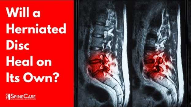 Видео Will a Herniated Disc Heal on Its Own? (SURPRISING ANSWER) на русском