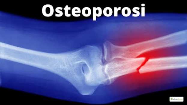 Video Non è una malattia e si può curare senza farmaci po polsku