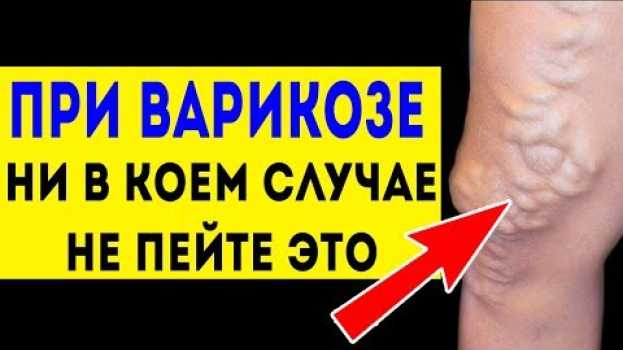 Video НИКОГДА не пейте это при ВАРИКОЗЕ (варикозное расширение вен) Лечение народными средствами en français