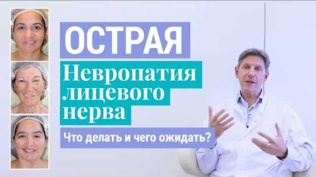 Video Паралич Белла: Что делать и чего ожидать при острой невропатии (неврите) лицевого нерва en français