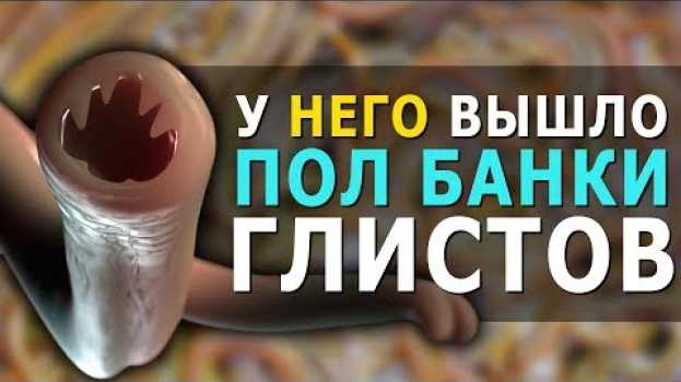 Video ОН СДЕЛАЛ ЭТО И ВЫГНАЛ ПОЛБАНКИ ГЛИСТОВ! Паразиты, рецепт чистки от глистов, остеохондроз шеи. auf Deutsch