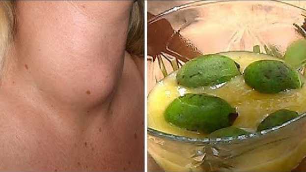Video I Medici Non Te Lo Diranno Mai Cura La Tiroide con Un Solo Ingrediente! en français