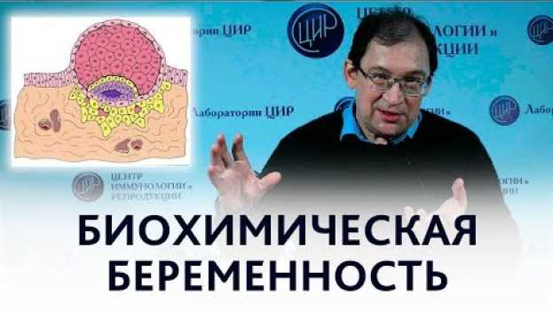 Video Биохимическая беременность после ЭКО и причины нарушения имплантации. Отвечает Гузов И.И. po polsku