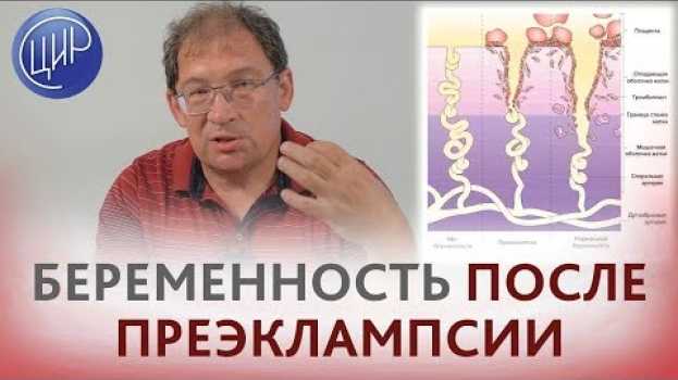 Video Преэклампсия. Как выносить беременность, если была преэклампсия и в городе нет гемостазиолога. su italiano