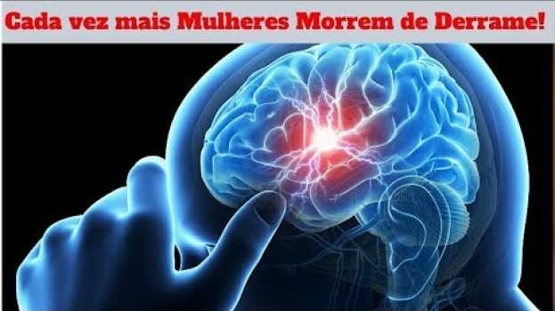 Video Cada vez mais Mulheres Morrem de Derrame, Aqui estão os Motivos e os Sinais de Alerta! po polsku