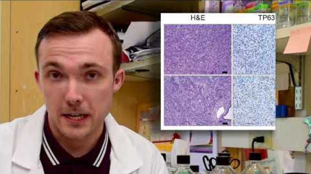 Video Pancreatic cancer’s addiction could be its end en español