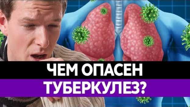 Video ТУБЕРКУЛЕЗ ЛЕГКИХ. Чем опасен? Как заражаются? Симптомы и смертность! in English