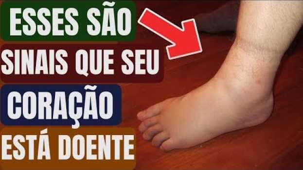 Видео Se Você Tem Esses Sintomas Estranhos Seu Coração Pode Não Estar Funcionando Como Deveria! на русском