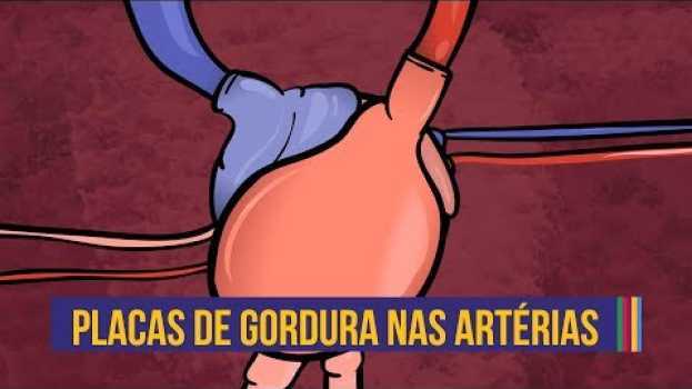 Video Como se formam as placas de gordura | Animação #08 su italiano