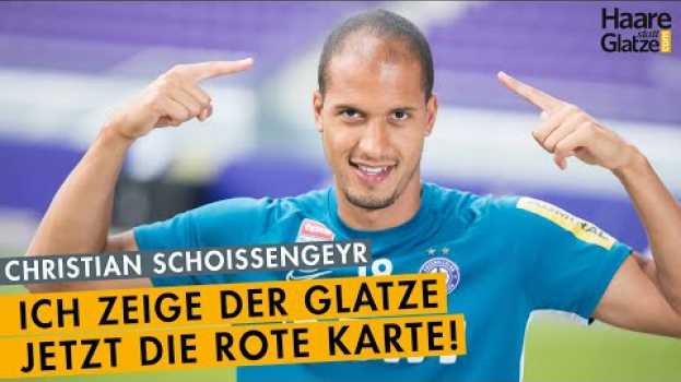 Video Dieser Austria Wien Fussball-Profi hat sich Haare transplantieren lassen en español