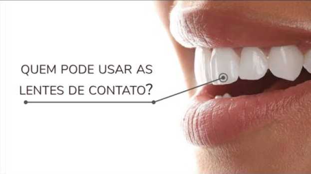 Video Você já ouviu falar de lentes de contato dental? | Dra. Nanda Menezes en español