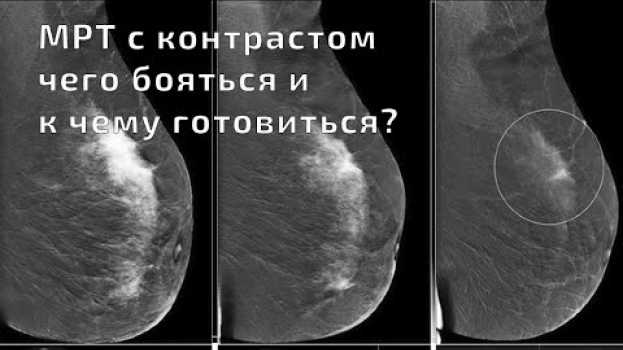 Video МРТ с контрастом: чего бояться и к чему готовиться in English