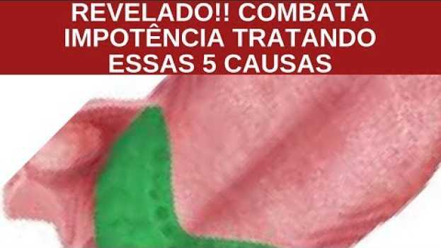 Видео Impotência  Sexual Não É  Uma Doença MAS UM  SINTOMA на русском