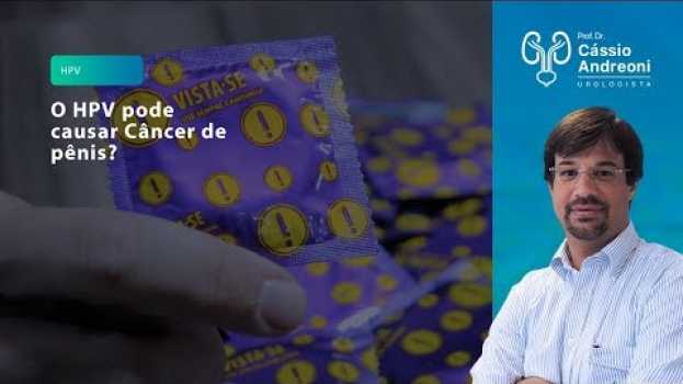 Video O HPV pode causar Câncer de Pênis? | Dr. Cassio Andreoni CRM 78.546 en français