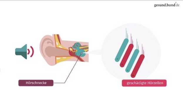 Video Was ist ein Tinnitus?   türkçe