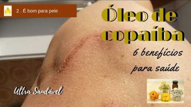 Video 6 benefícios do óleo de copaíba, o que é, no que ele ajuda para saúde! auf Deutsch