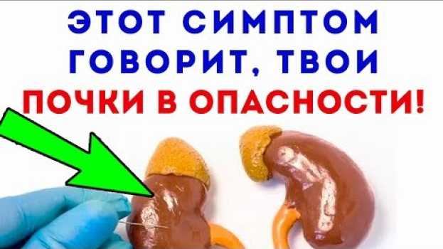 Video СИМПТОМ КОТОРЫЙ ОЩУЩАЕМ, может быть последним… Почки su italiano