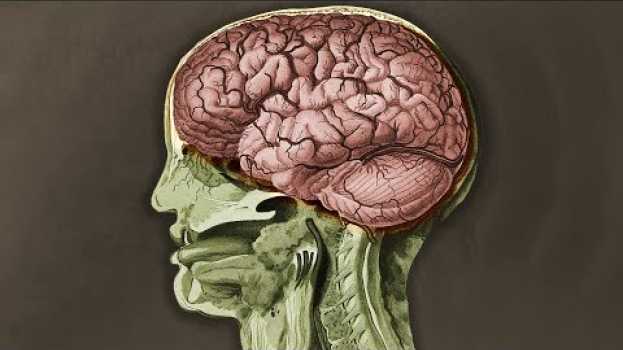 Video A TikToker Drank 1 Bottle Nutmeg Spice. This Is What Happened To His Brain. em português