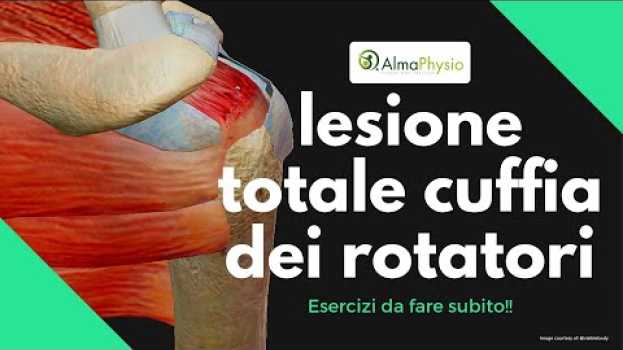 Video lesione Totale cuffia dei rotatori: esercizi (da fare subito!!!)   türkçe