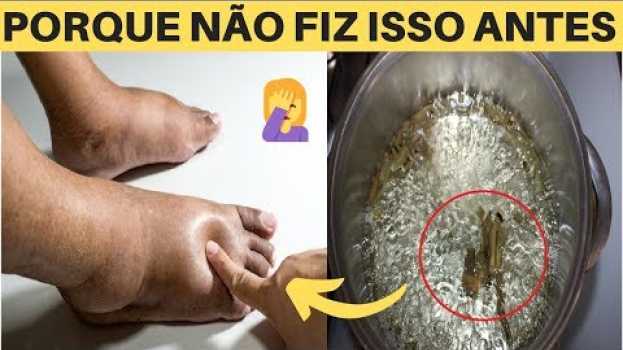 Video O Inchaço Nos Pés e Pernas Irão Desaparecer Quando Você Começar a Usar Este Chá po polsku