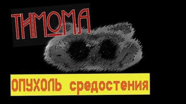 Video Увеличение вилочковой железы. Тимома средостения на МРТ расшифровке. Где находится тимус en français