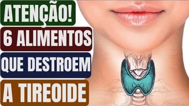 Video Atenção! Estes são os 6 Alimentos que estão Destruindo a sua Tireoide!   türkçe