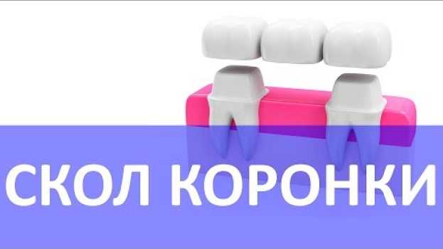 Video Скол коронок - как этого не допустить | Миография | T-SCAN   türkçe