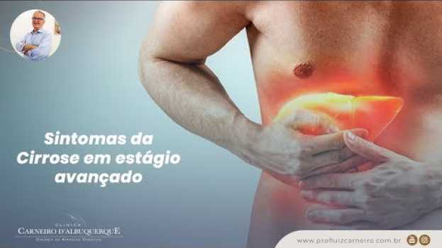 Video Sintomas da Cirrose em estágio avançado | Prof. Dr. Luiz Carneiro CRM 22761 su italiano