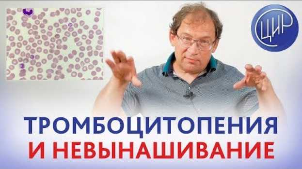 Video Тромбоцитопения и невынашивание. Есть ли связь между тромбоцитопенией и невынашиванием. Гузов И.И. auf Deutsch