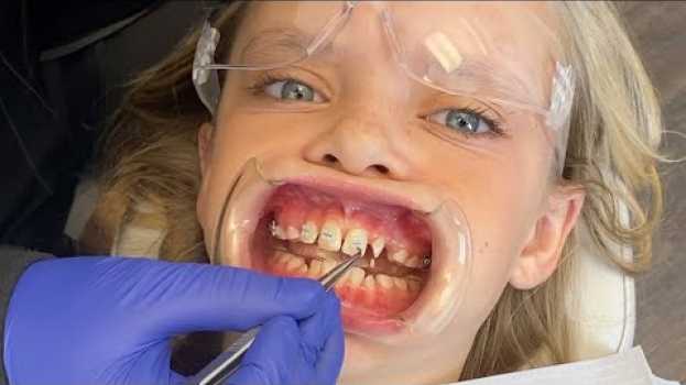 Video I had a Crazy Dream I got Braces! Jazzy Skye su italiano