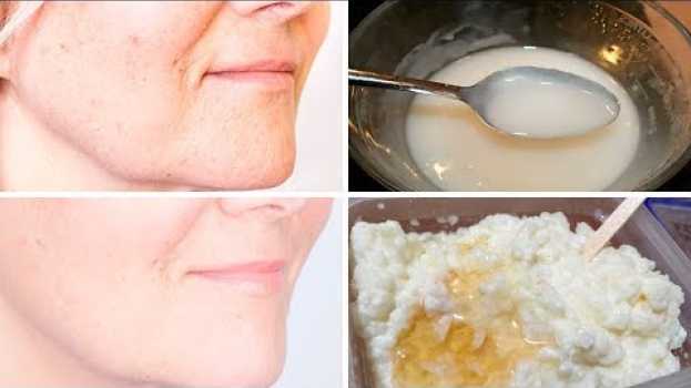 Video Faça Esta Máscara Facial Eficaz Para Rejuvenescer 10 Anos Do Seu Rosto en français