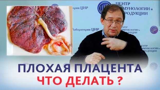 Video ПЛОХАЯ ПЛАЦЕНТА. ЧТО ДЕЛАТЬ если врач сказал, что была плохая плацента? Отвечает доктор Гузов. po polsku