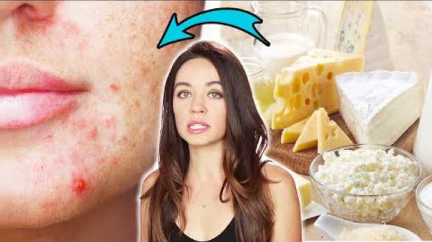 Video Nutritionists Reveal Which Foods Affect Your Acne auf Deutsch