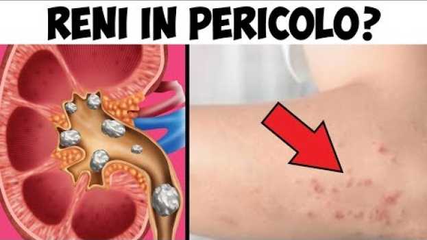 Video 10 segnali che i vostri reni hanno bisogno di aiuto   türkçe