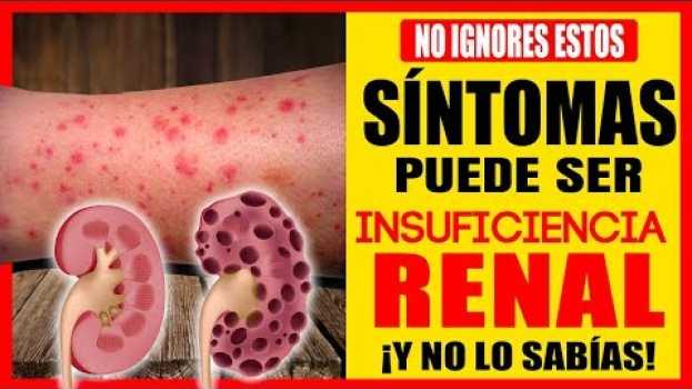 Video Mira Estos Síntomas Que Indica Que Tus Riñones Están Enfermos  | 7 Síntomas De Insuficiencia Renal auf Deutsch