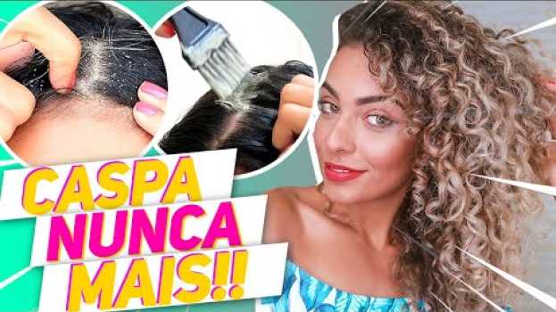 Video TRANSIÇÃO CAPILAR SEM CASPA Em Cabelo Cacheado E PONTAS SECAS? RESOLVA AGORA @Faladantas po polsku