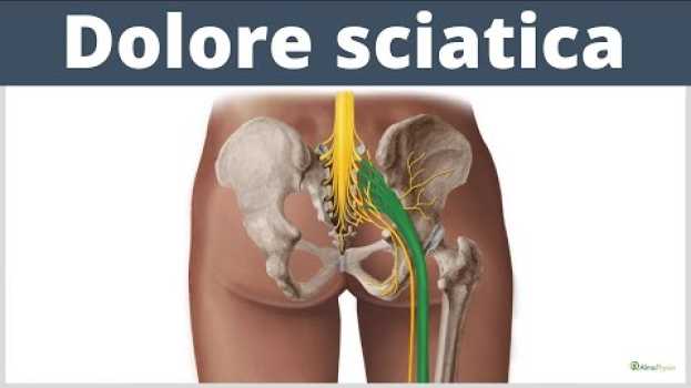 Video CURA la SCIATICA con questo SEMPLICE ESERCIZIO auf Deutsch