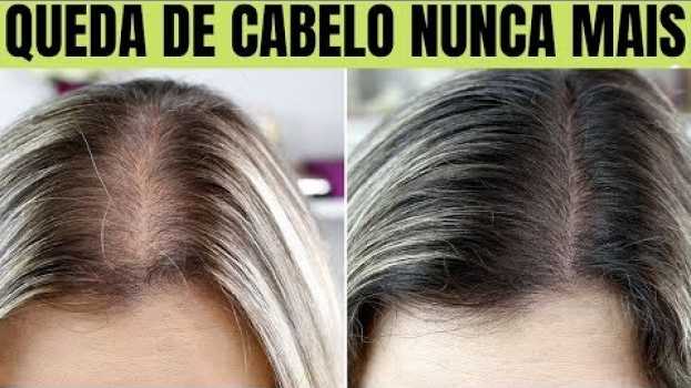 Video Meu Cabelo Estava Caindo! Então Usei Isso e Meu Cabelo Parou de Cair e Cresceu Muito!😱   türkçe