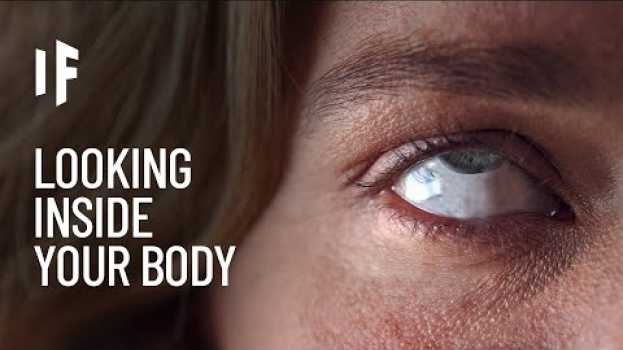 Video What If We Could Look Inside Our Bodies? po polsku