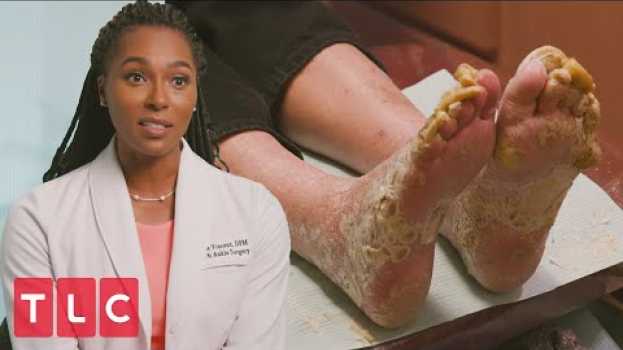 Video Sneak Peek: My Feet Are Killing Me su italiano
