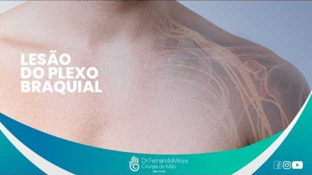 Video Lesões do plexo braquial: o que são, causas e tratamento | Dr. Fernando Moya CRM 112.046 su italiano