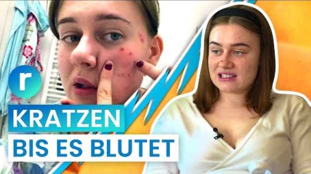 Video Skin Picking: Ab wann ist Pickel ausdrücken eine Krankheit? I reporter en español