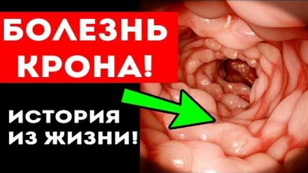 Video Вот как ПИТАНИЕ ПОБЕДИЛО серьезный ДИАГНОЗ! Воспаление кишечника ВЗК (болезнь Крона) po polsku