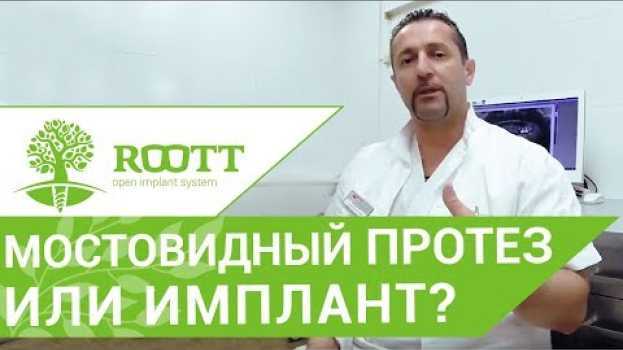 Video Имплант или мостовидный протез. 🤔 Что выбрать мостовидный протез или имплант? su italiano