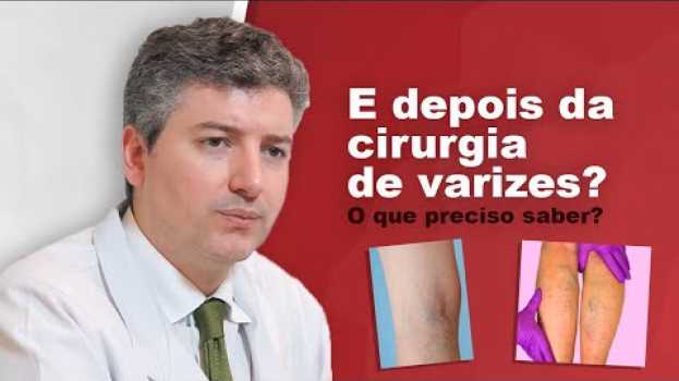 Video Como é o pós operatório da cirurgia de Varizes convencional/tradicional su italiano