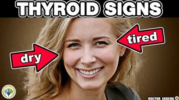 Video 10 Urgent Signs Your Thyroid Is In Trouble su italiano