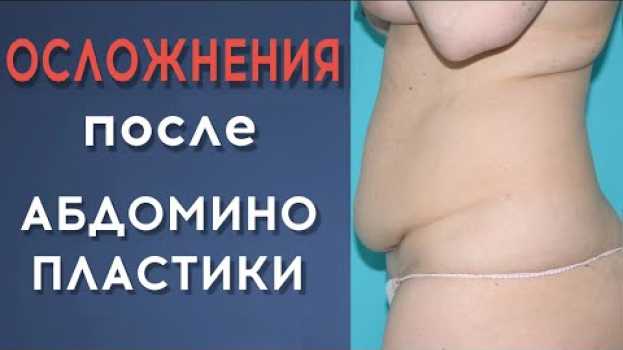 Video Осложнения после абдоминопластики: чем опасна операция? en français