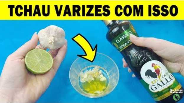 Video Acabe Com as VARIZES  Naturalmente Com ALHO LIMÃO E AZEITE - VARIZES Tratamento Caseiro in English